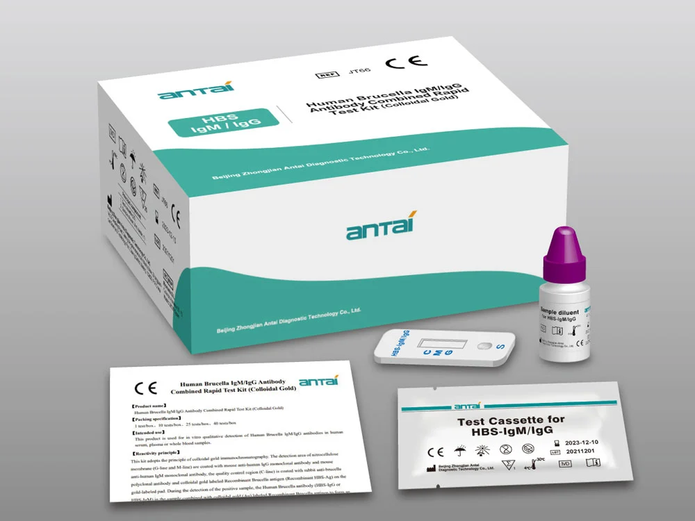 anti hbc igg test